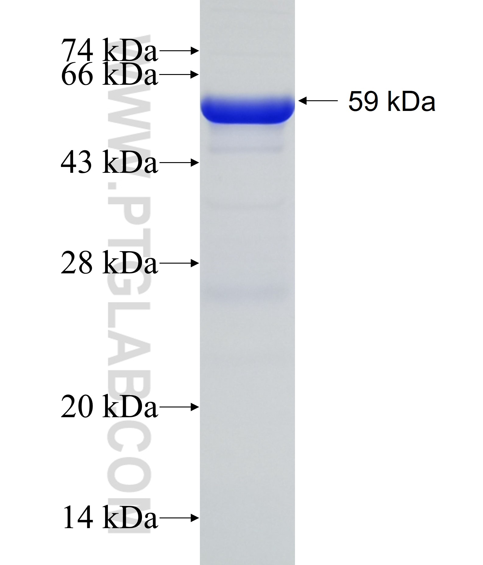 THOC6 fusion protein Ag30341 SDS-PAGE THOC6 fusion protein Ag30341 SDS-PAGE