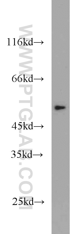 WB analysis of A431 using 10139-1-AP