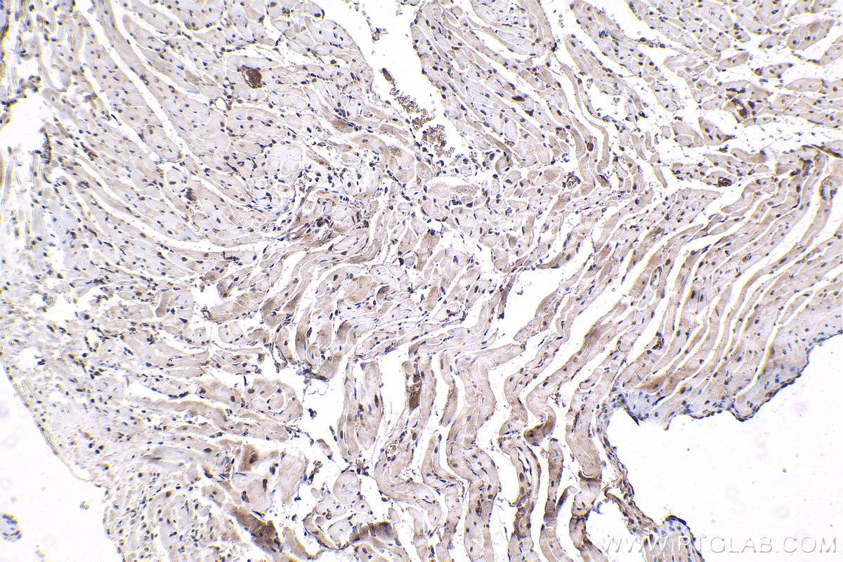 IHC staining of rat heart using 66703-1-Ig (same clone as 66703-1-PBS)
