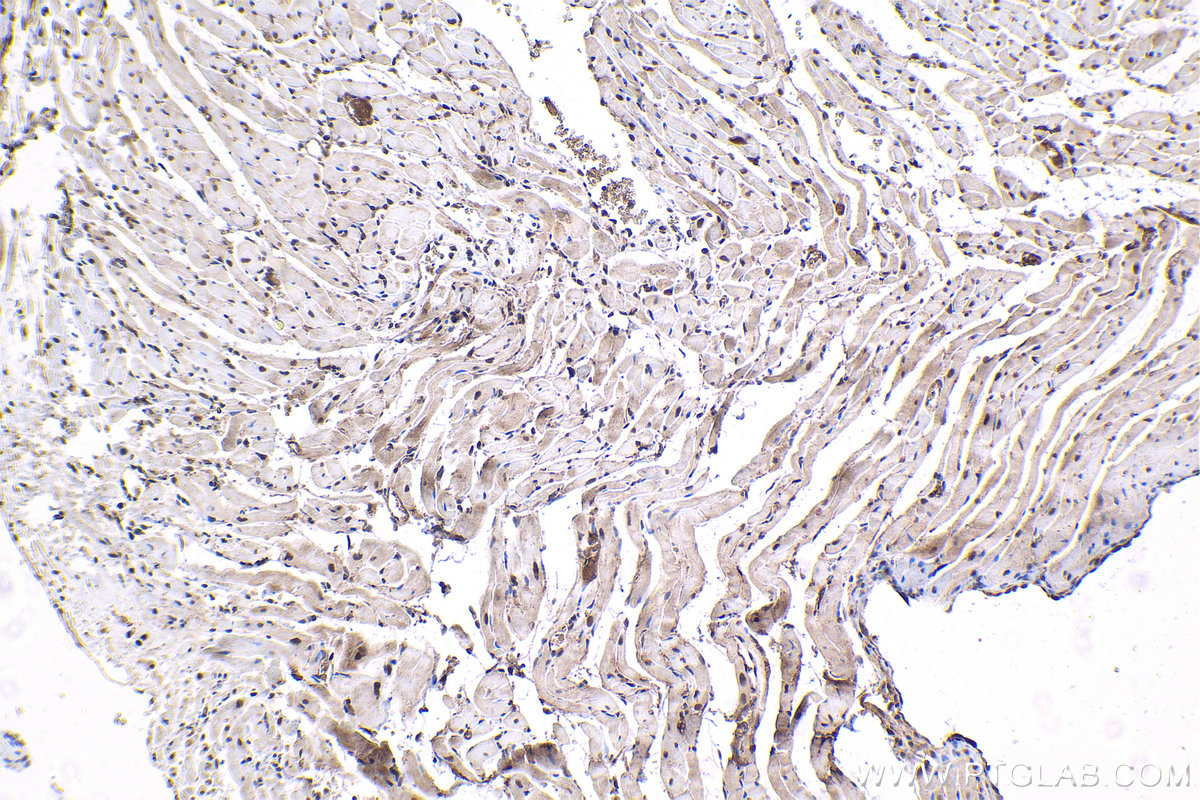 IHC staining of rat heart using 66703-1-Ig