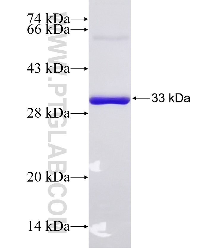 THRA fusion protein Ag27189 SDS-PAGE