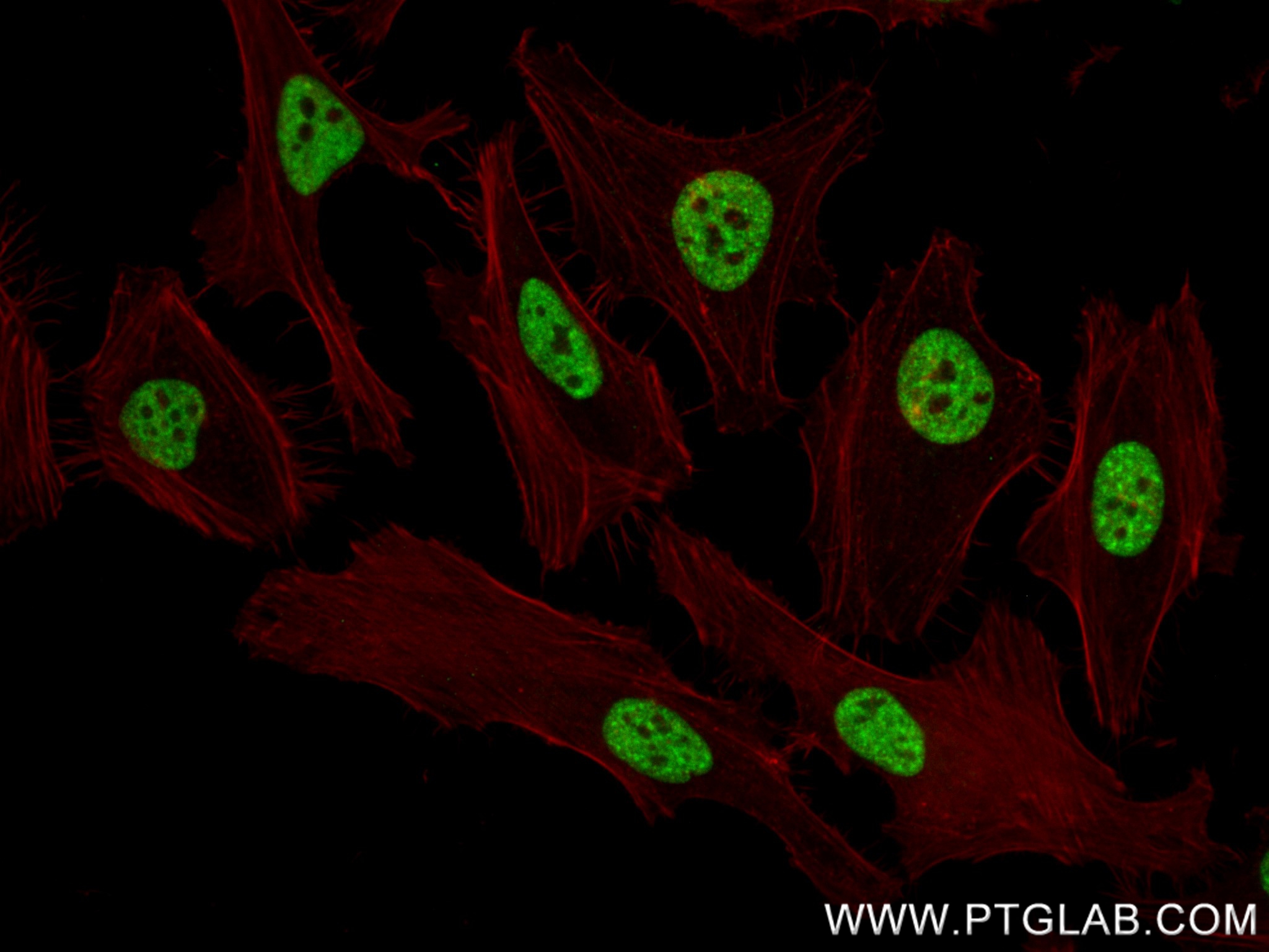 IF Staining of HeLa using 85093-1-RR