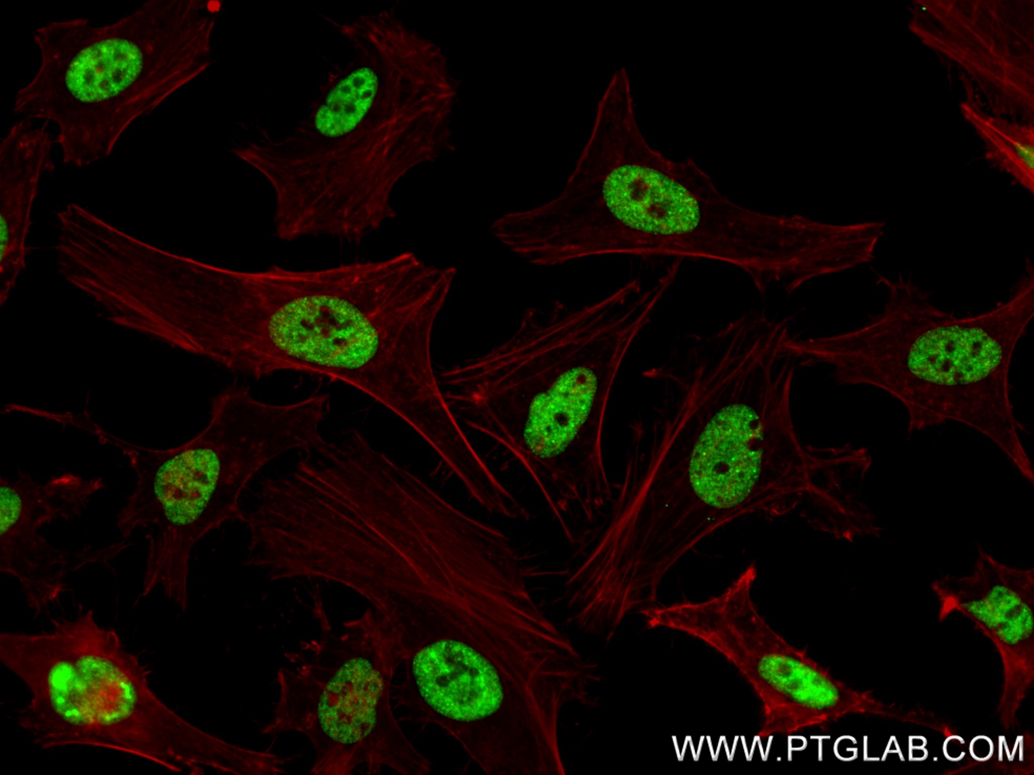 IF Staining of HeLa using 85093-2-RR