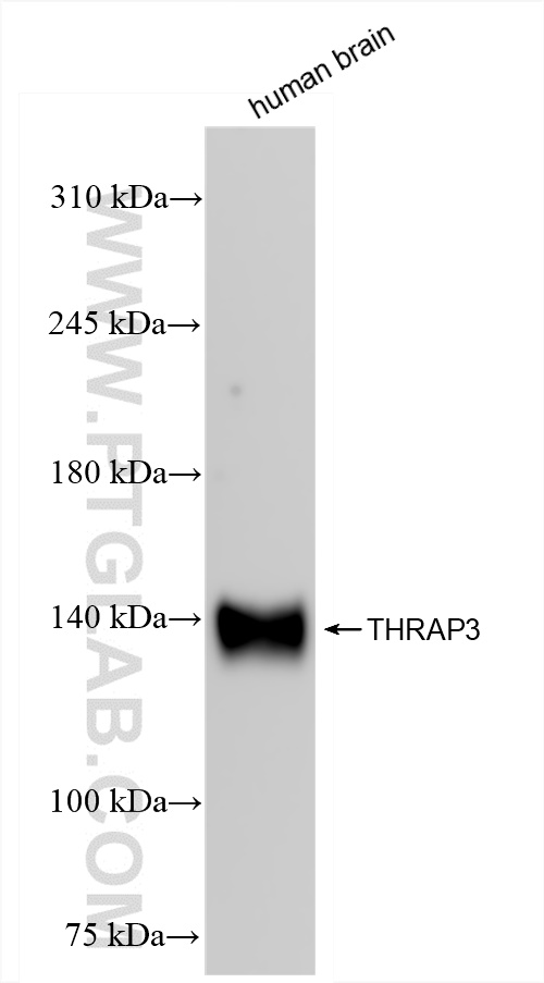 WB analysis of human brain using 85093-2-RR