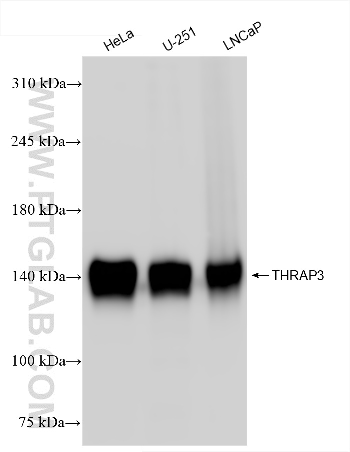 WB analysis using 85093-3-RR