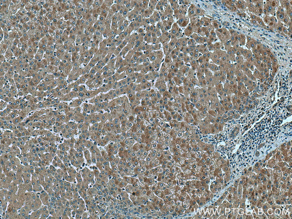 IHC staining of human liver using 13054-1-AP