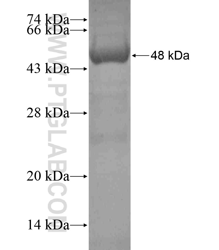 THSD1 fusion protein Ag17631 SDS-PAGE THSD1 fusion protein Ag17631 SDS-PAGE