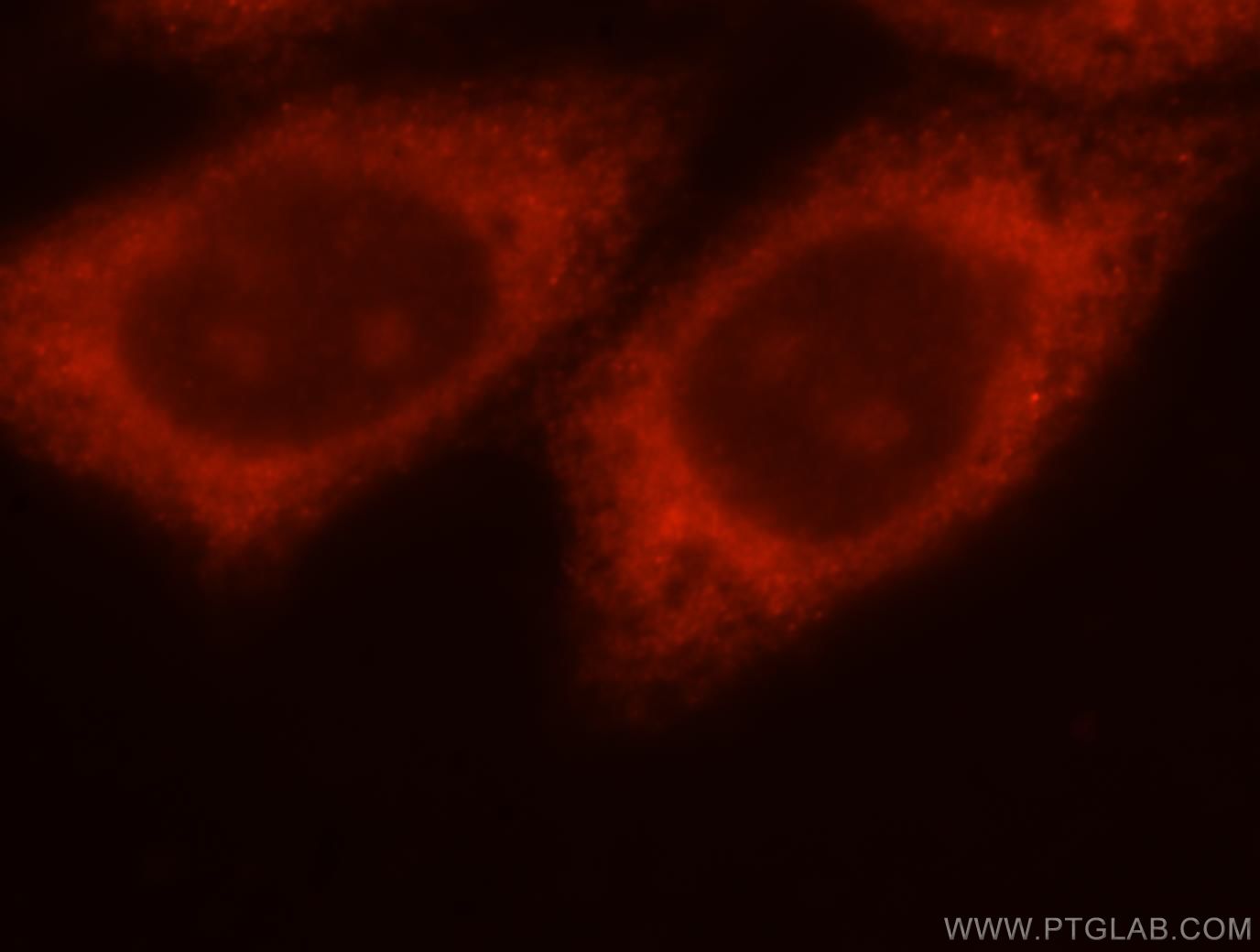 IF Staining of HepG2 using 15486-1-AP (same clone as 15486-1-PBS)