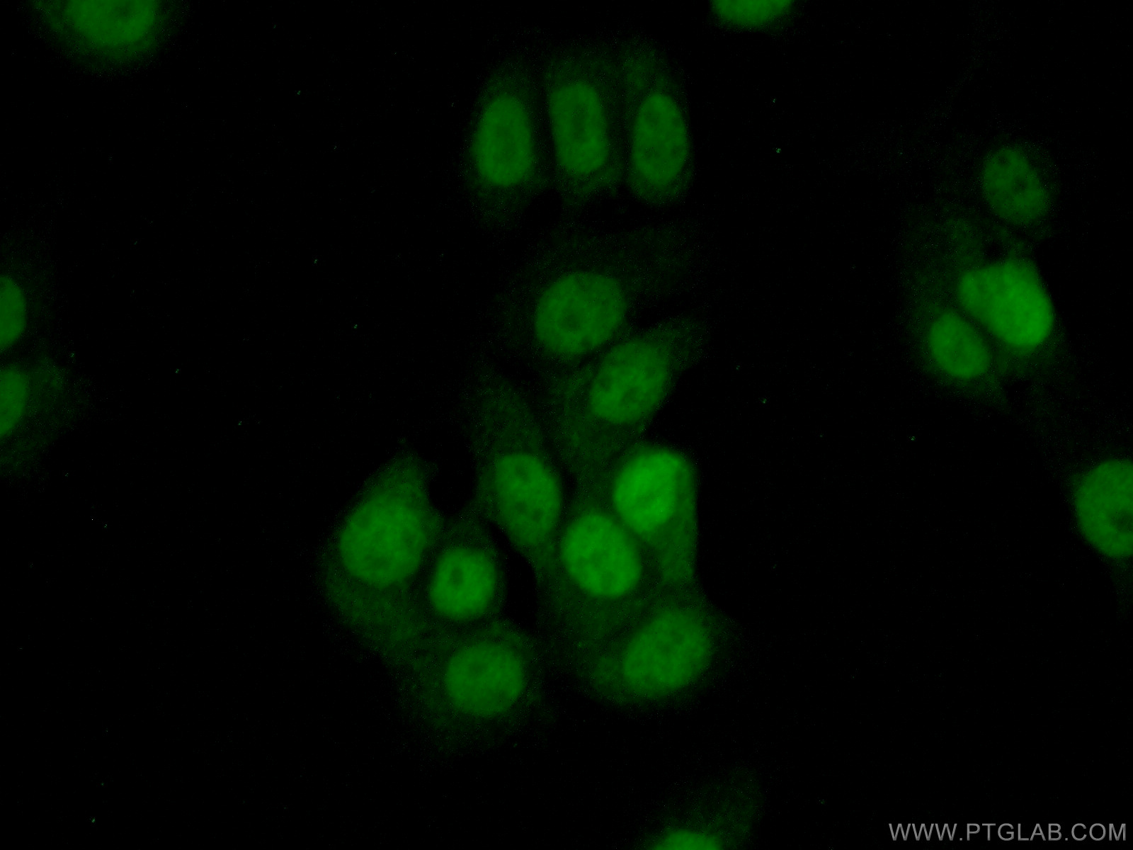 IF Staining of MCF-7 using 14921-1-AP
