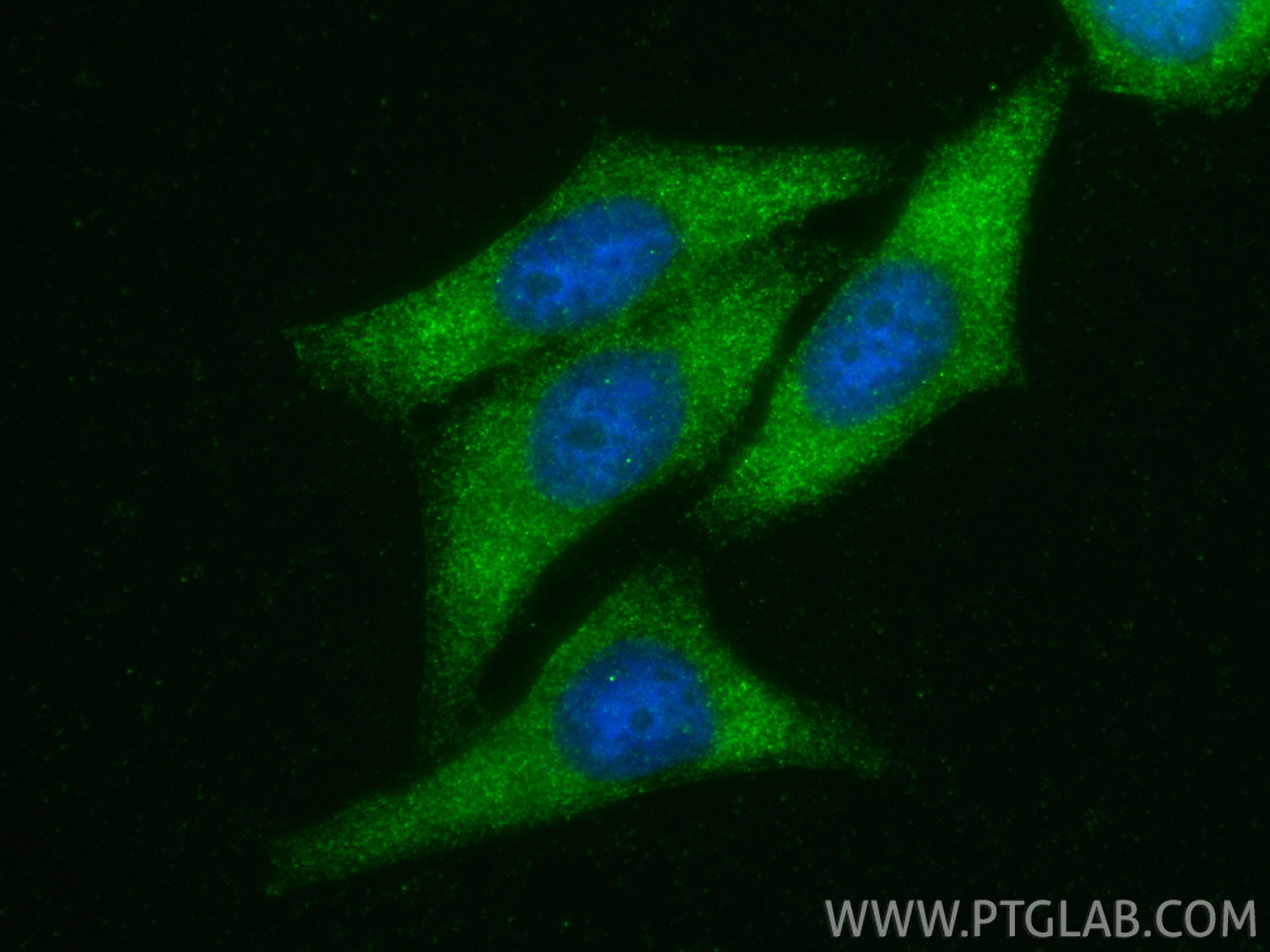 IF Staining of HepG2 using 19807-1-AP