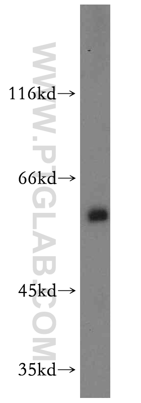 WB analysis of HeLa using 19807-1-AP