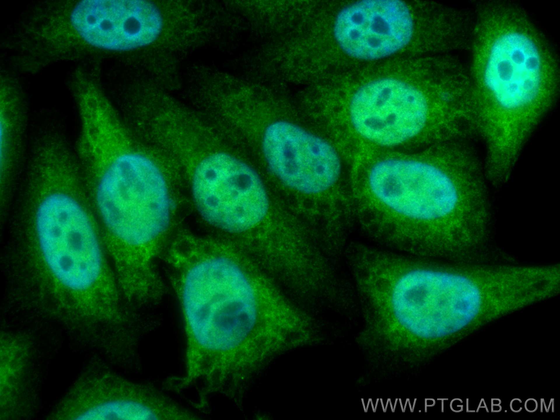 IF Staining of HepG2 using 12133-2-AP