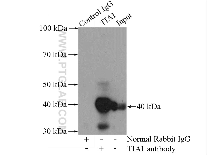 IP experiment of Jurkat using 12133-2-AP