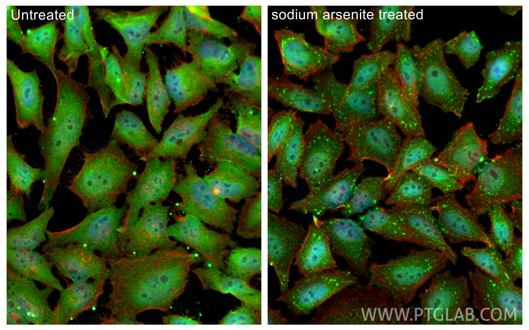 IF Staining of HeLa using 68486-1-Ig (same clone as 68486-1-PBS)