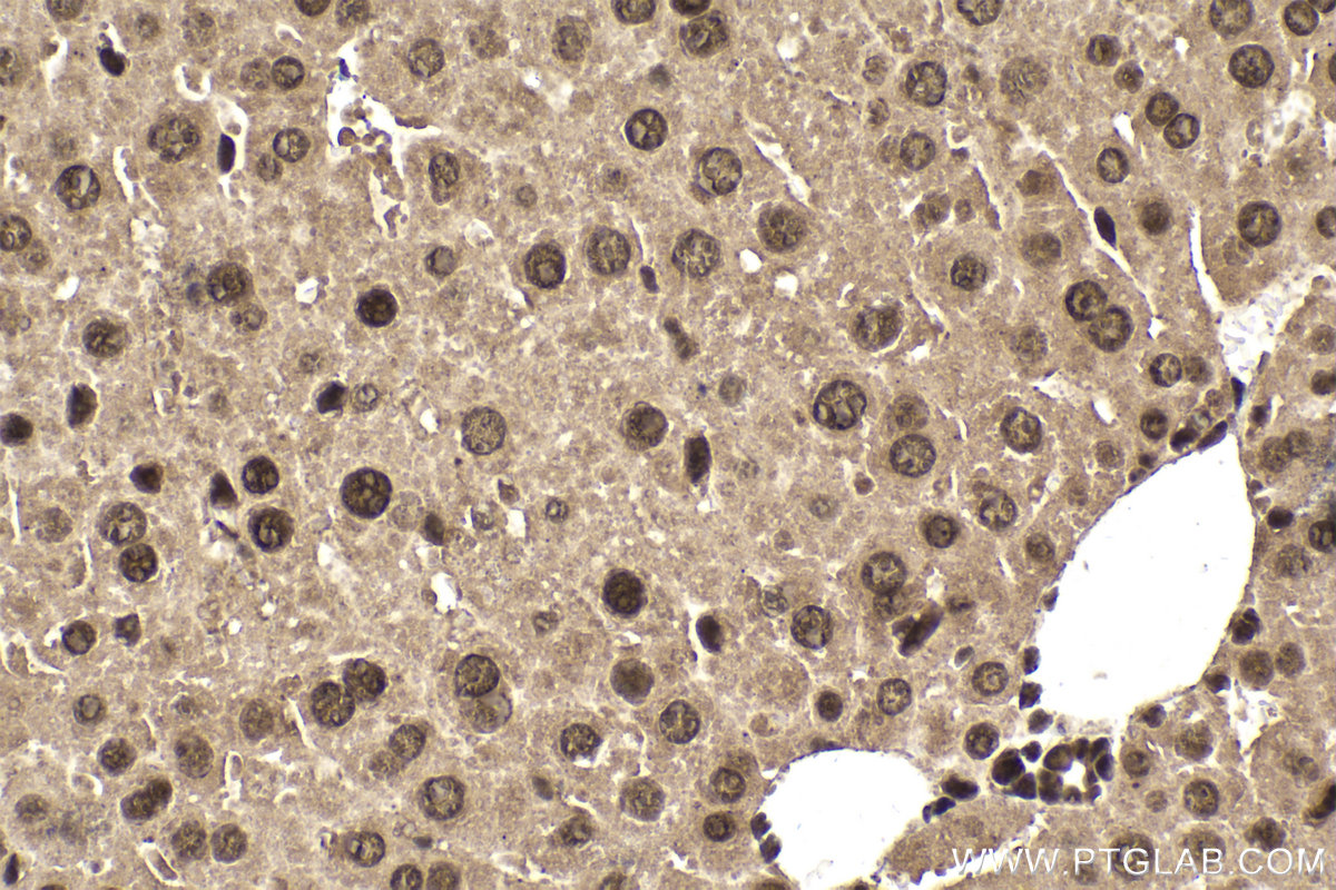 IHC staining of mouse liver using 68486-1-Ig