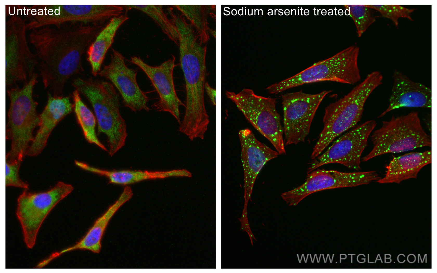 IF Staining of HeLa using 82672-1-RR (same clone as 82672-1-PBS)