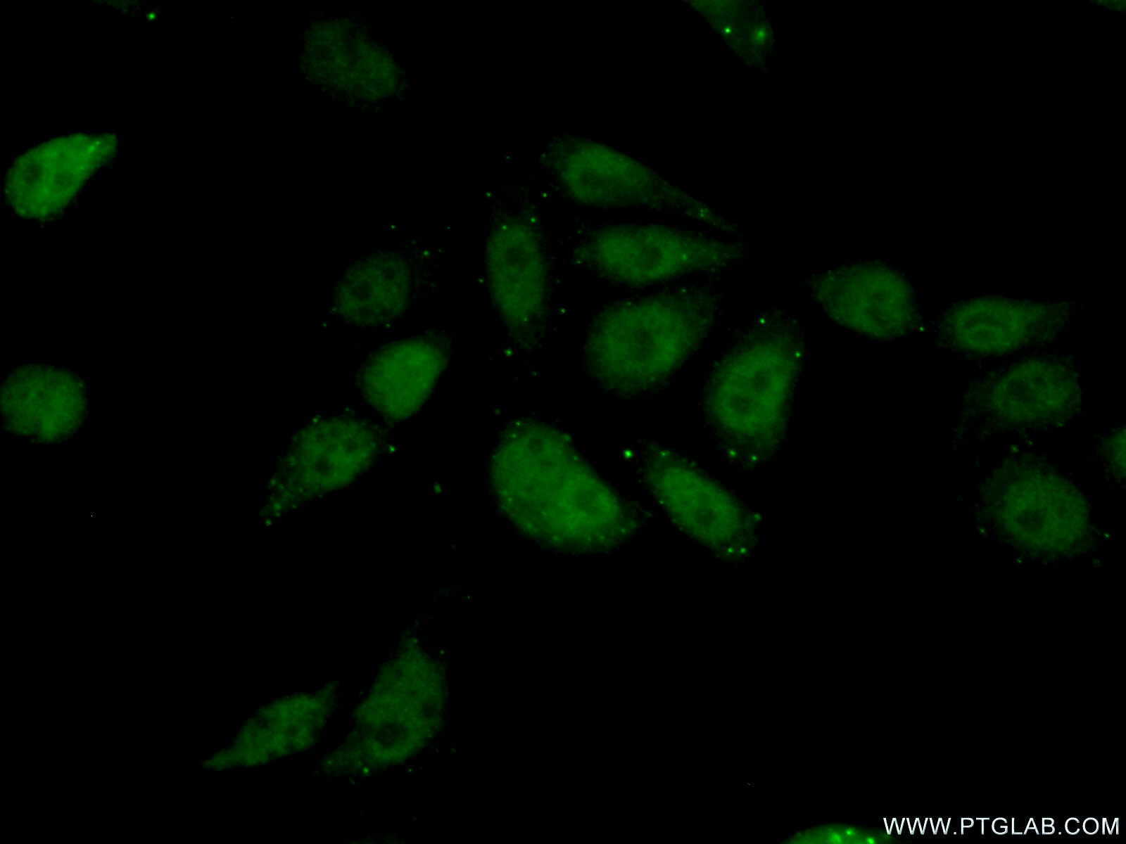 IF Staining of PC-3 using 20328-1-AP (same clone as 20328-1-PBS)
