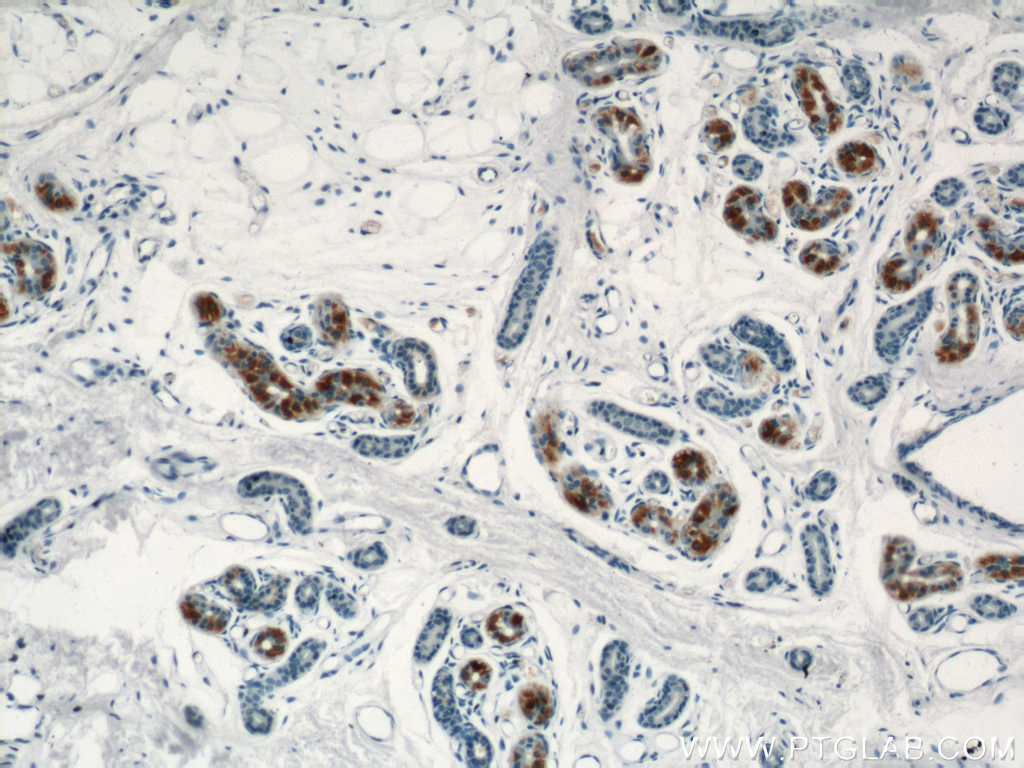IHC staining of human skin using 20328-1-AP (same clone as 20328-1-PBS)