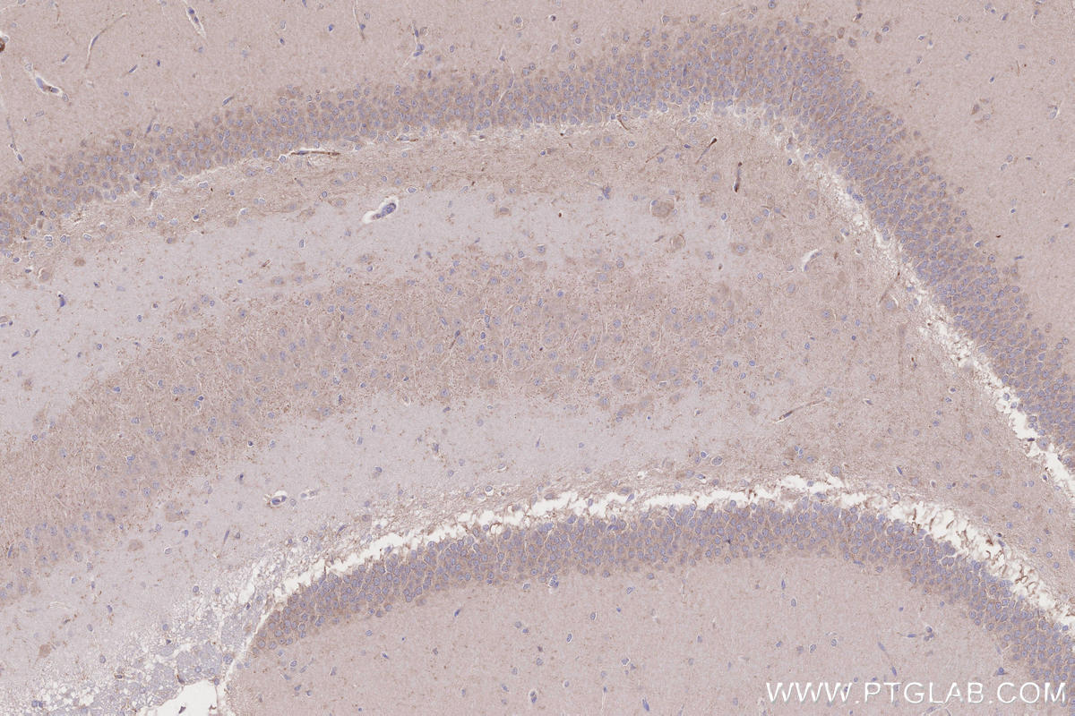 IHC staining of rat brain using 26870-1-AP