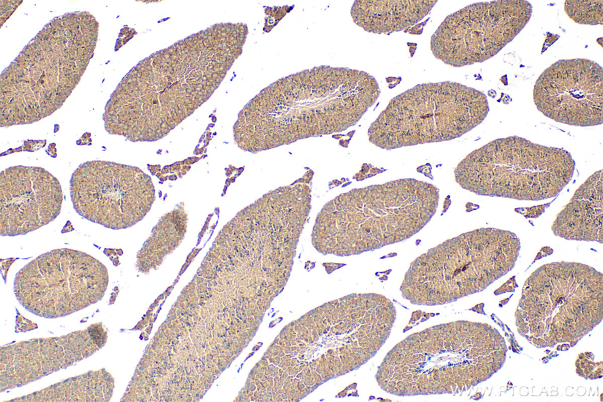 IHC staining of mouse testis using 19524-1-AP