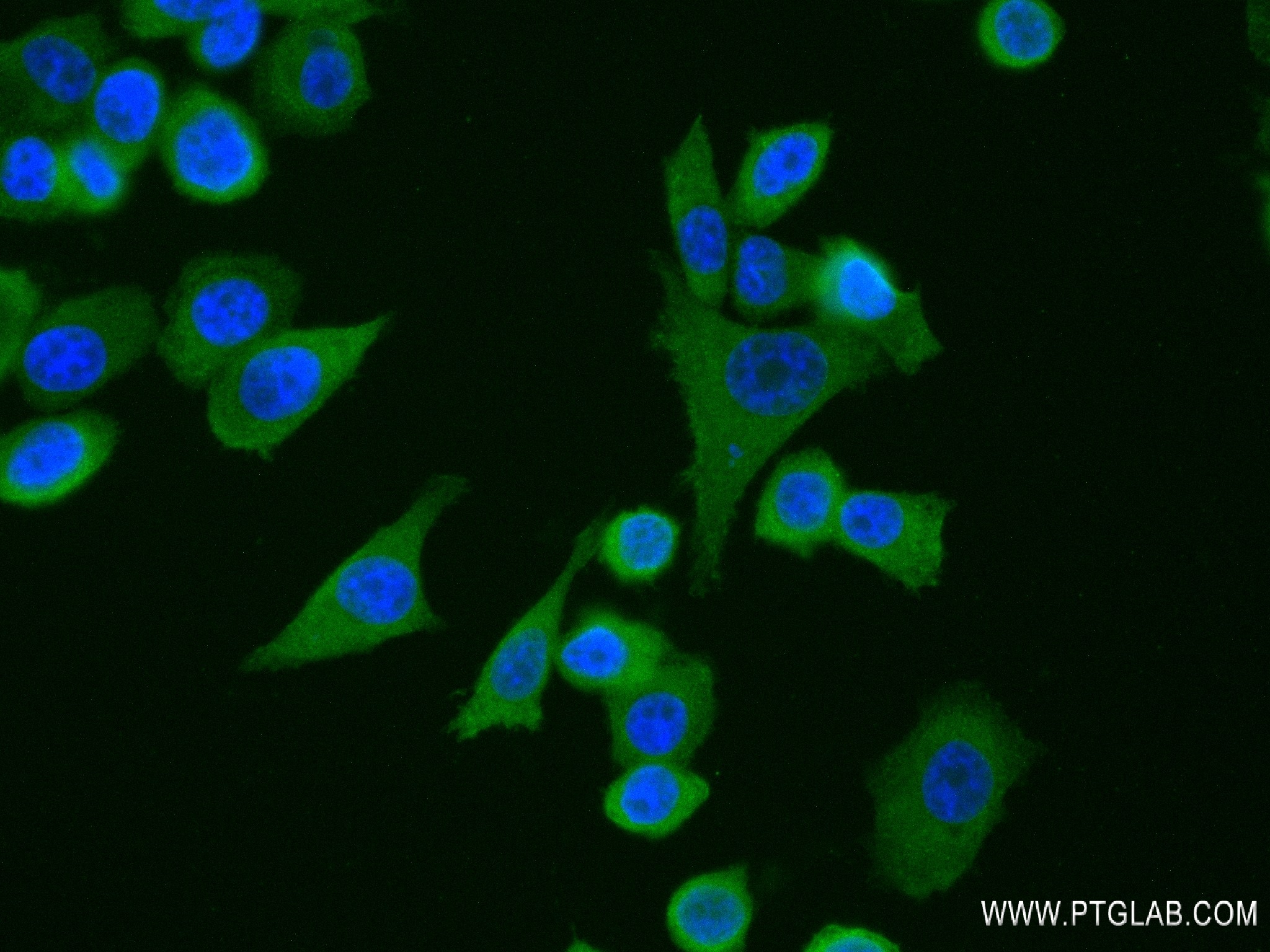 IF Staining of PC-3 using 84064-6-RR
