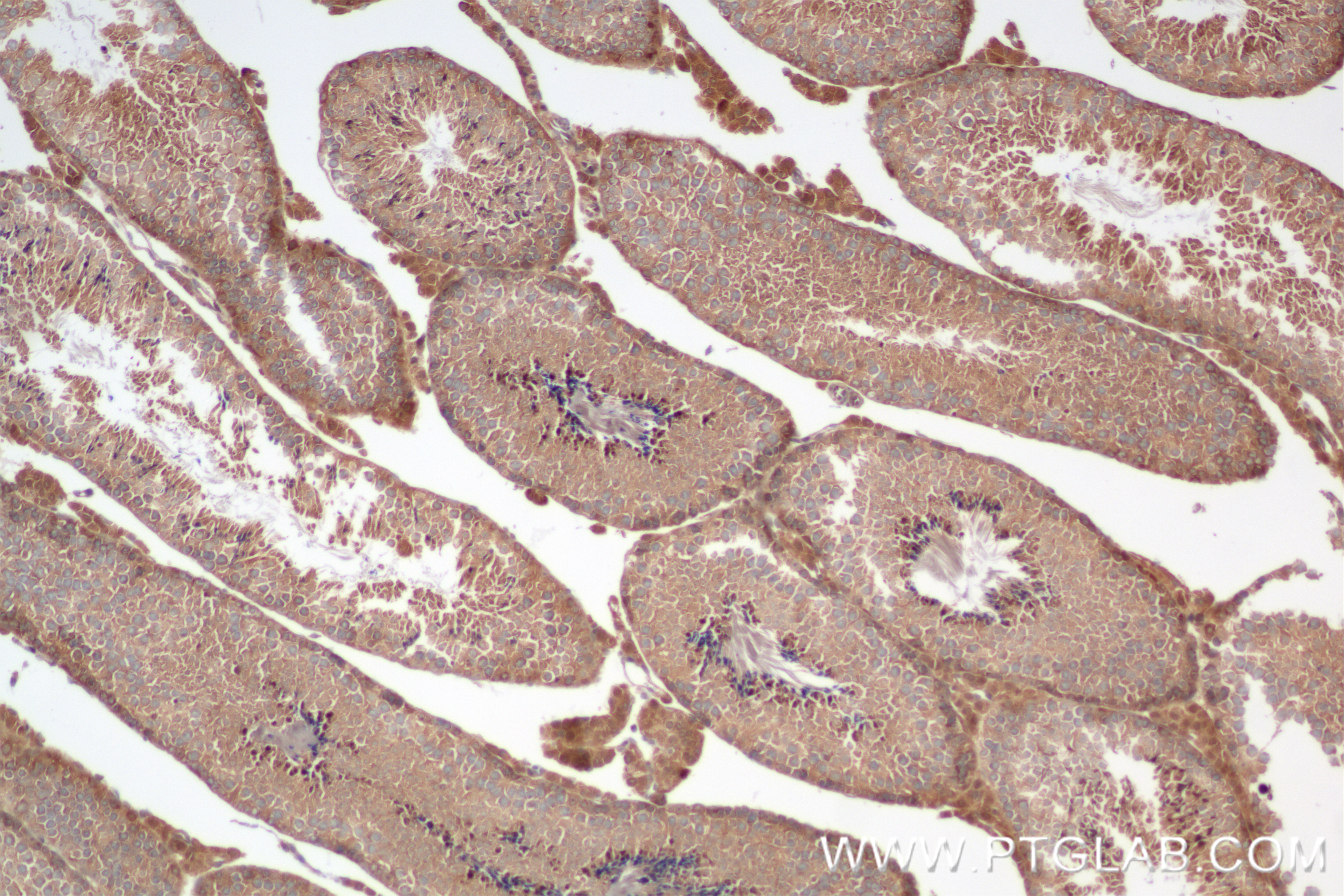 IHC staining of mouse testis using 84064-6-RR