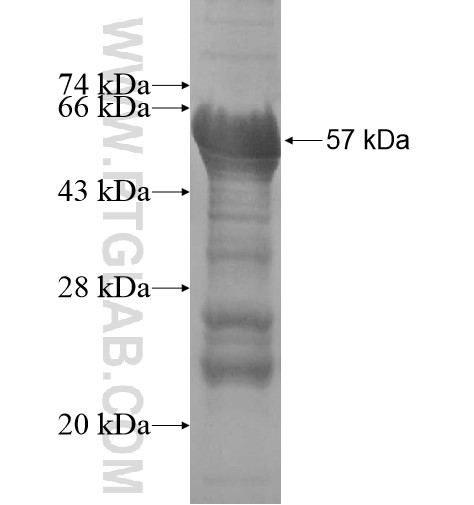 TICAM2 fusion protein Ag15989 SDS-PAGE TICAM2 fusion protein Ag15989 SDS-PAGE