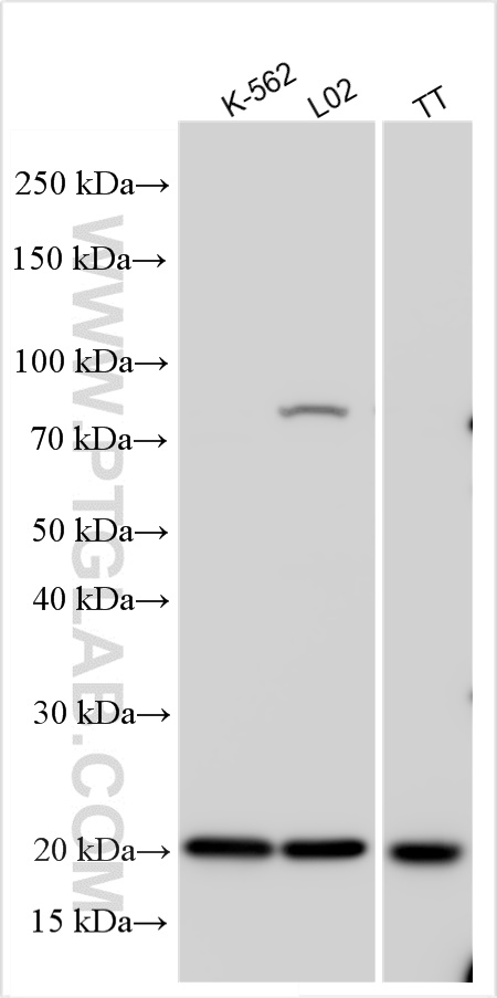 WB analysis using 11333-1-AP