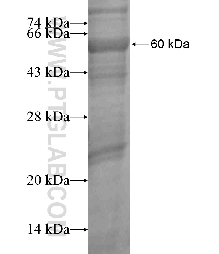 TIGAR fusion protein Ag17532 SDS-PAGE