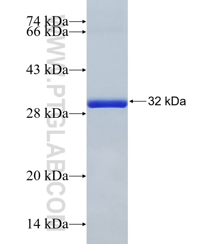 TIGAR fusion protein Ag17661 SDS-PAGE