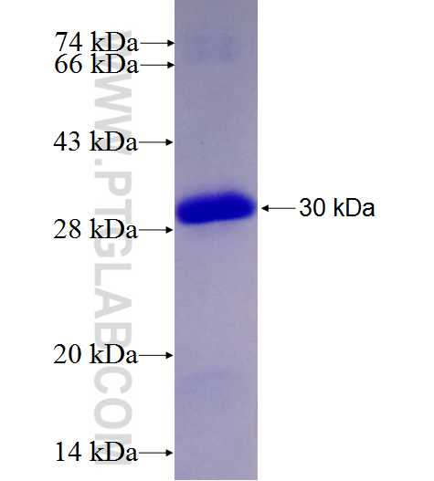TIGD3 fusion protein Ag27445 SDS-PAGE TIGD3 fusion protein Ag27445 SDS-PAGE