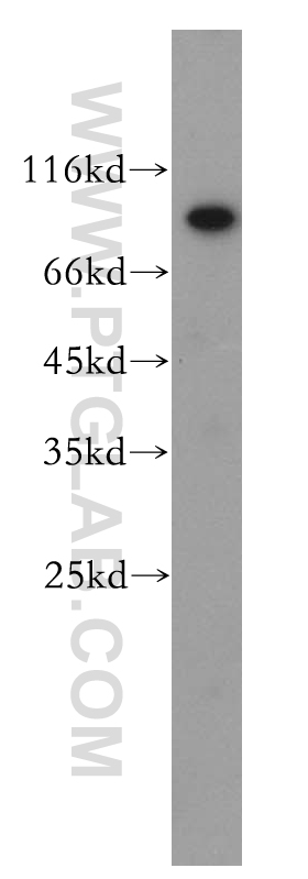 WB analysis of HeLa using 13644-1-AP