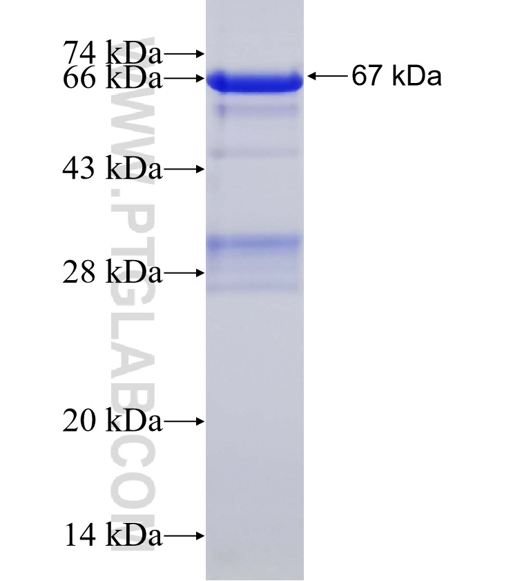 TIGD5 fusion protein Ag4590 SDS-PAGE