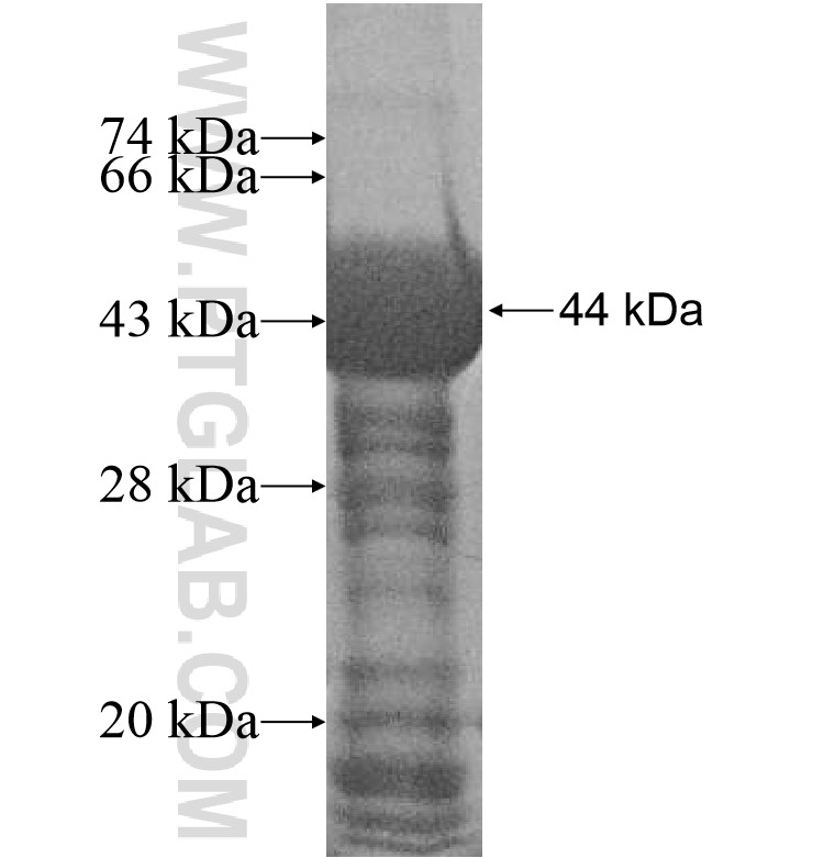TIGD7 fusion protein Ag16539 SDS-PAGE TIGD7 fusion protein Ag16539 SDS-PAGE