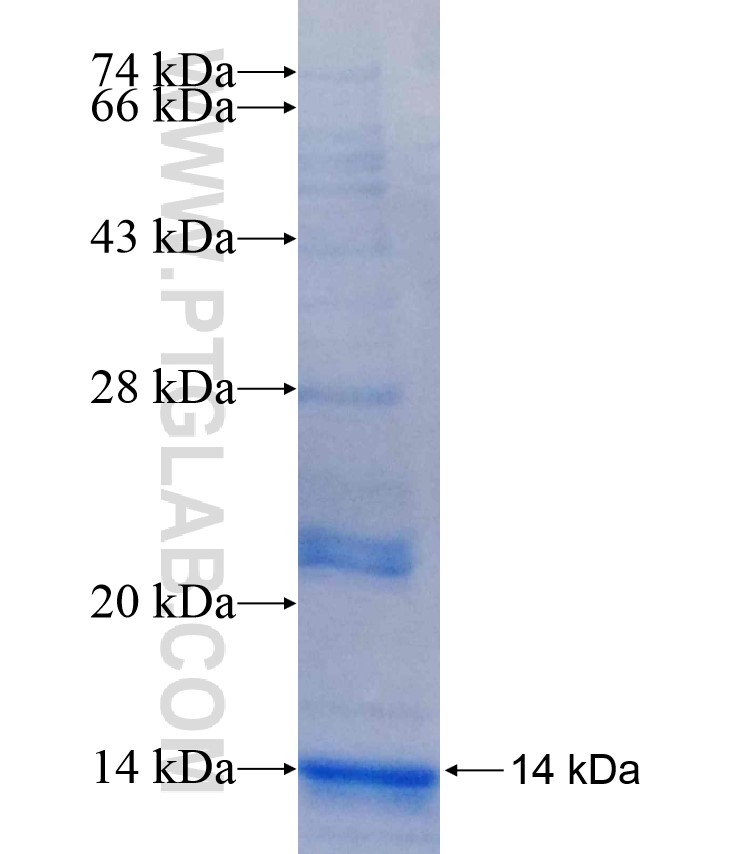 TIGIT fusion protein Ag17031 SDS-PAGE TIGIT fusion protein Ag17031 SDS-PAGE