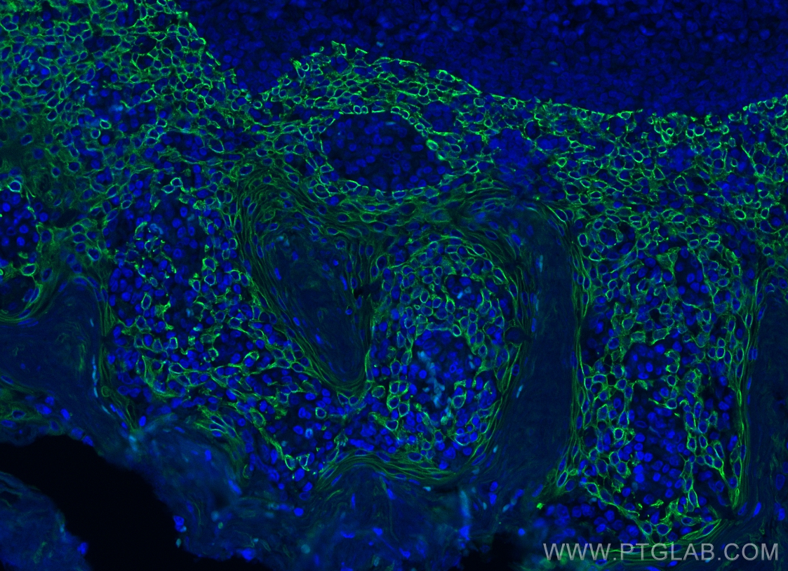 IF Staining of human tonsillitis using CL488-60355