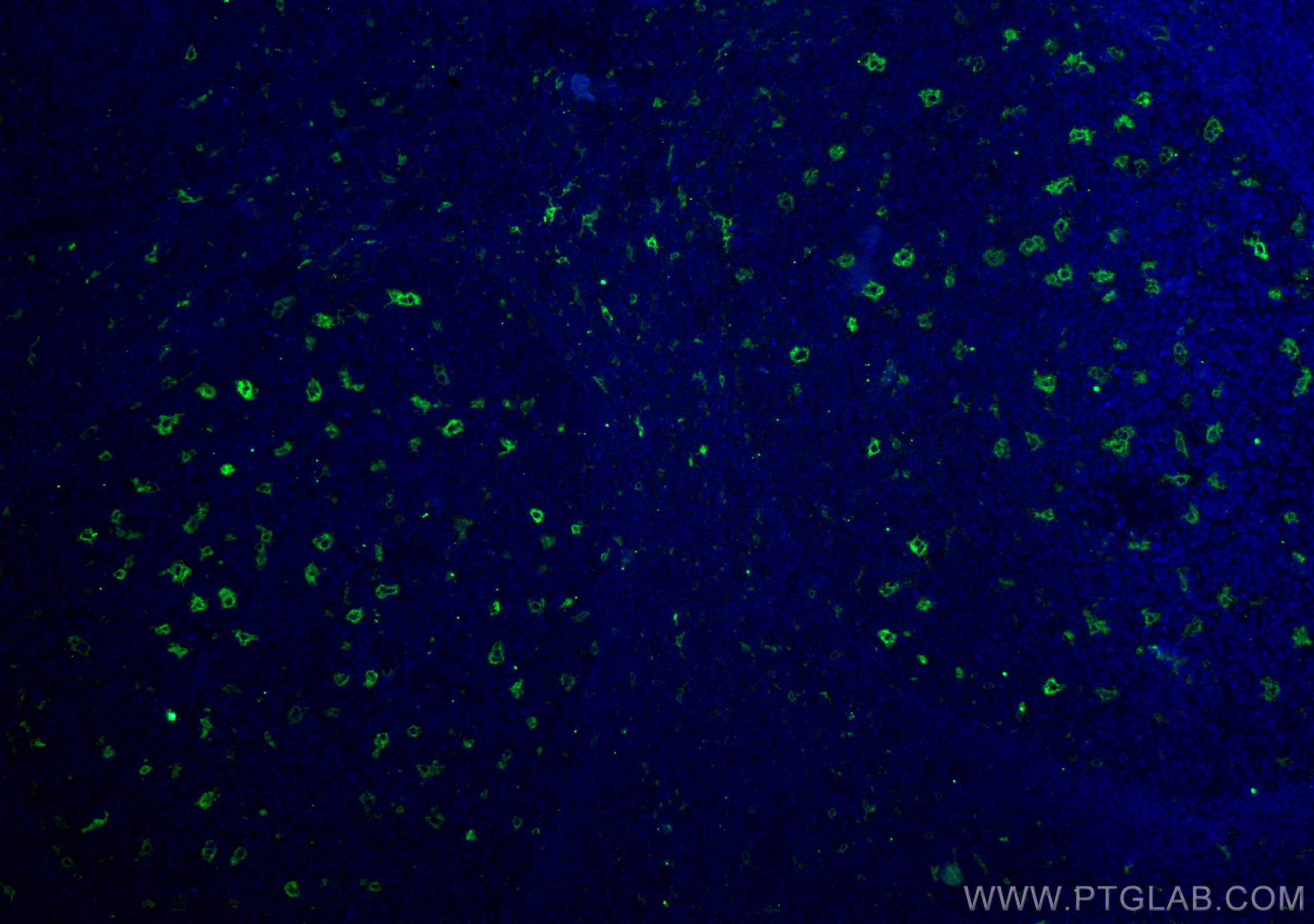 IF Staining of human tonsillitis using 12008-1-AP