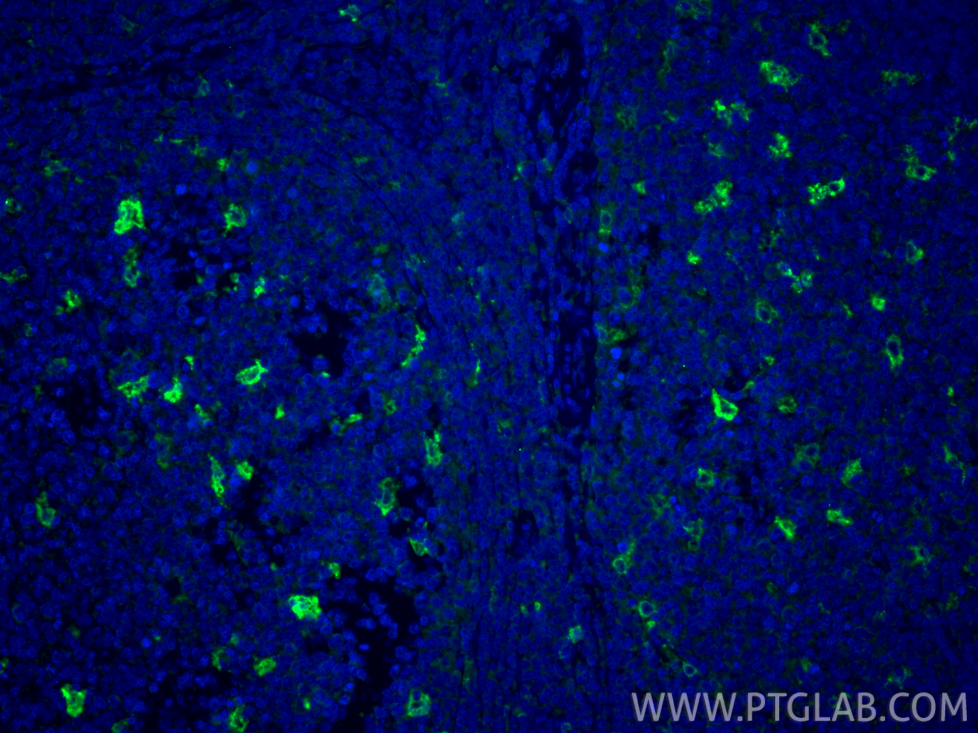 IF Staining of human tonsillitis using 12008-1-AP