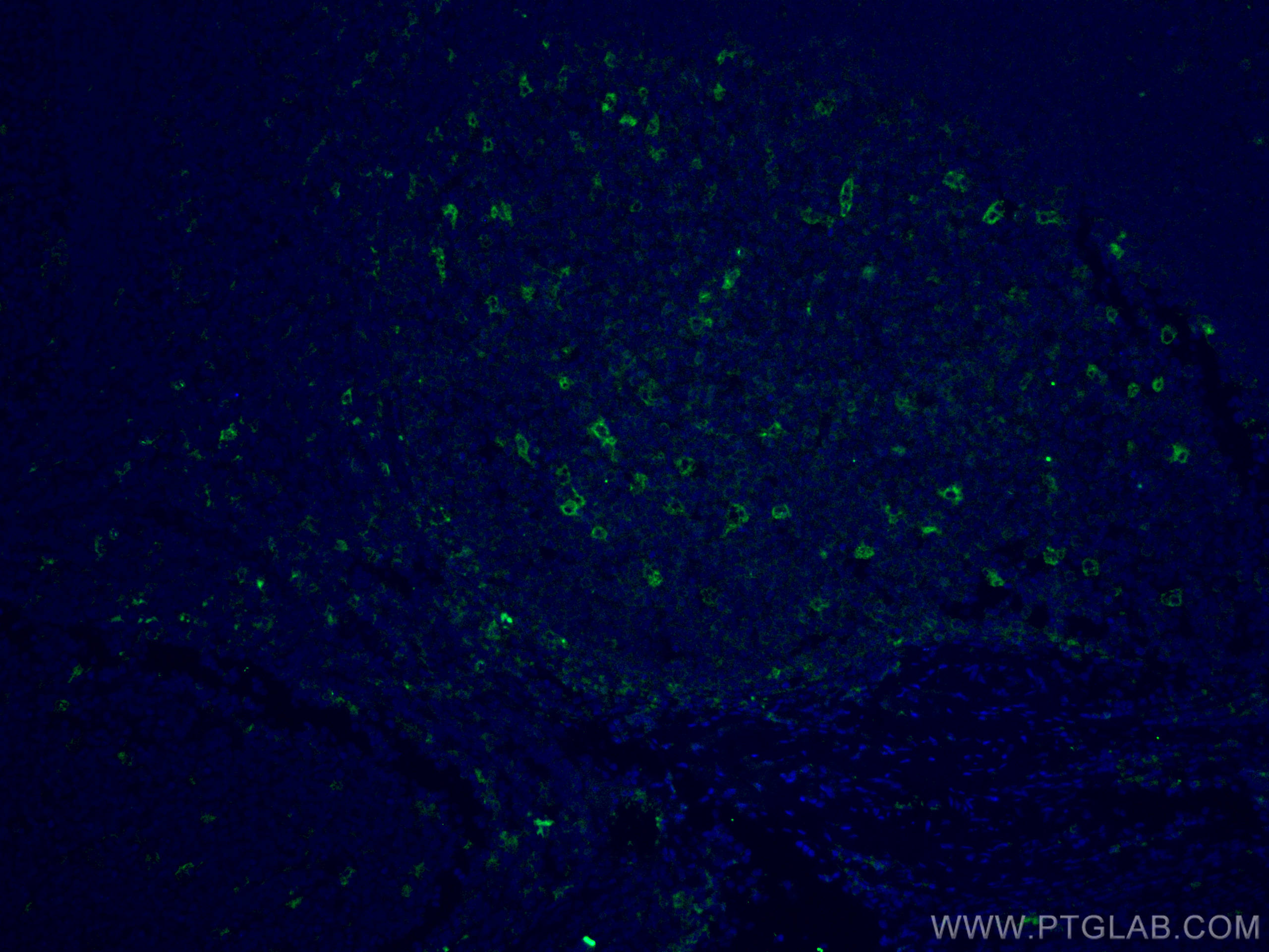 IF Staining of human tonsillitis using CL488-12008