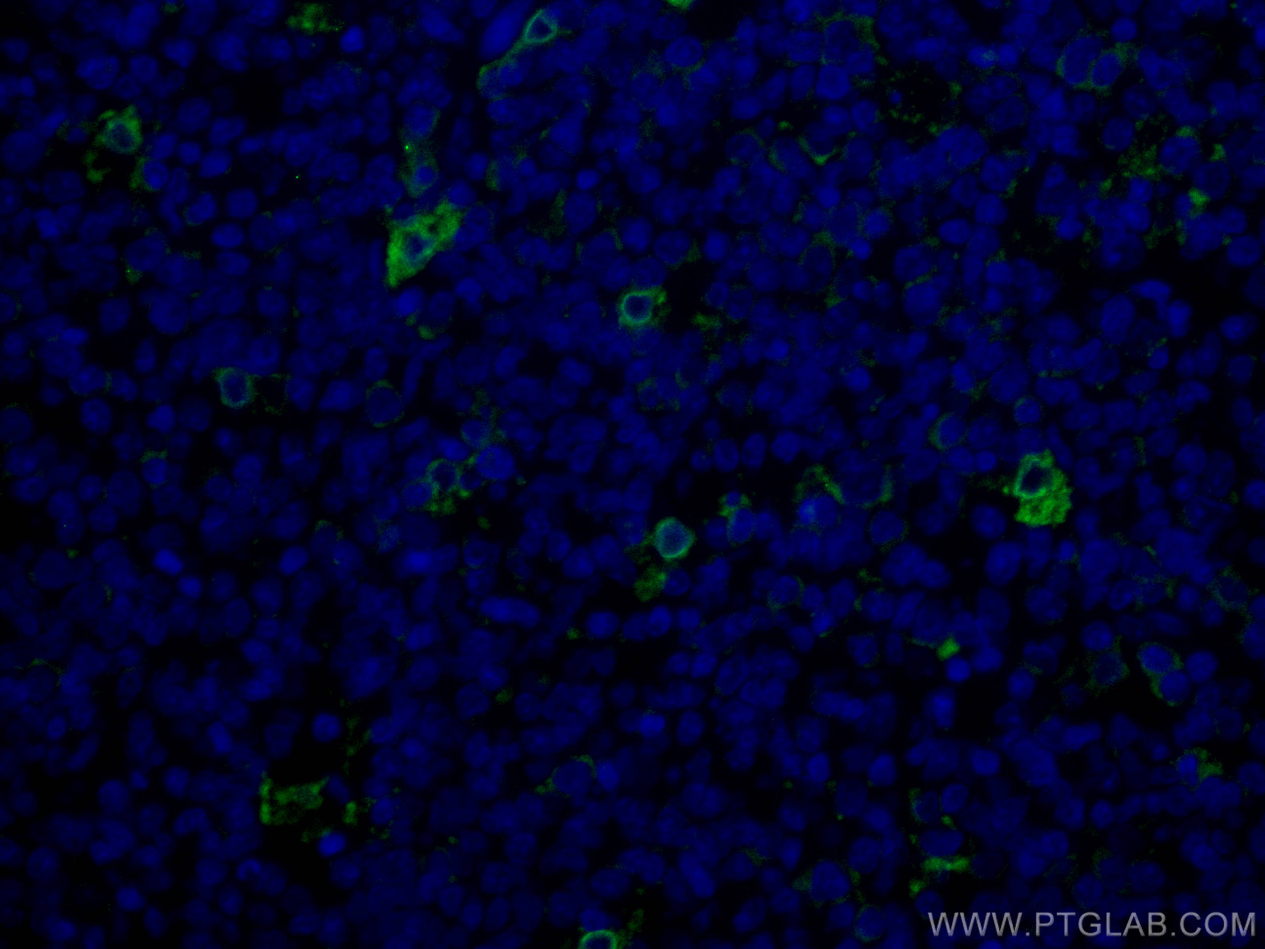 IF Staining of human tonsillitis using CL488-12008