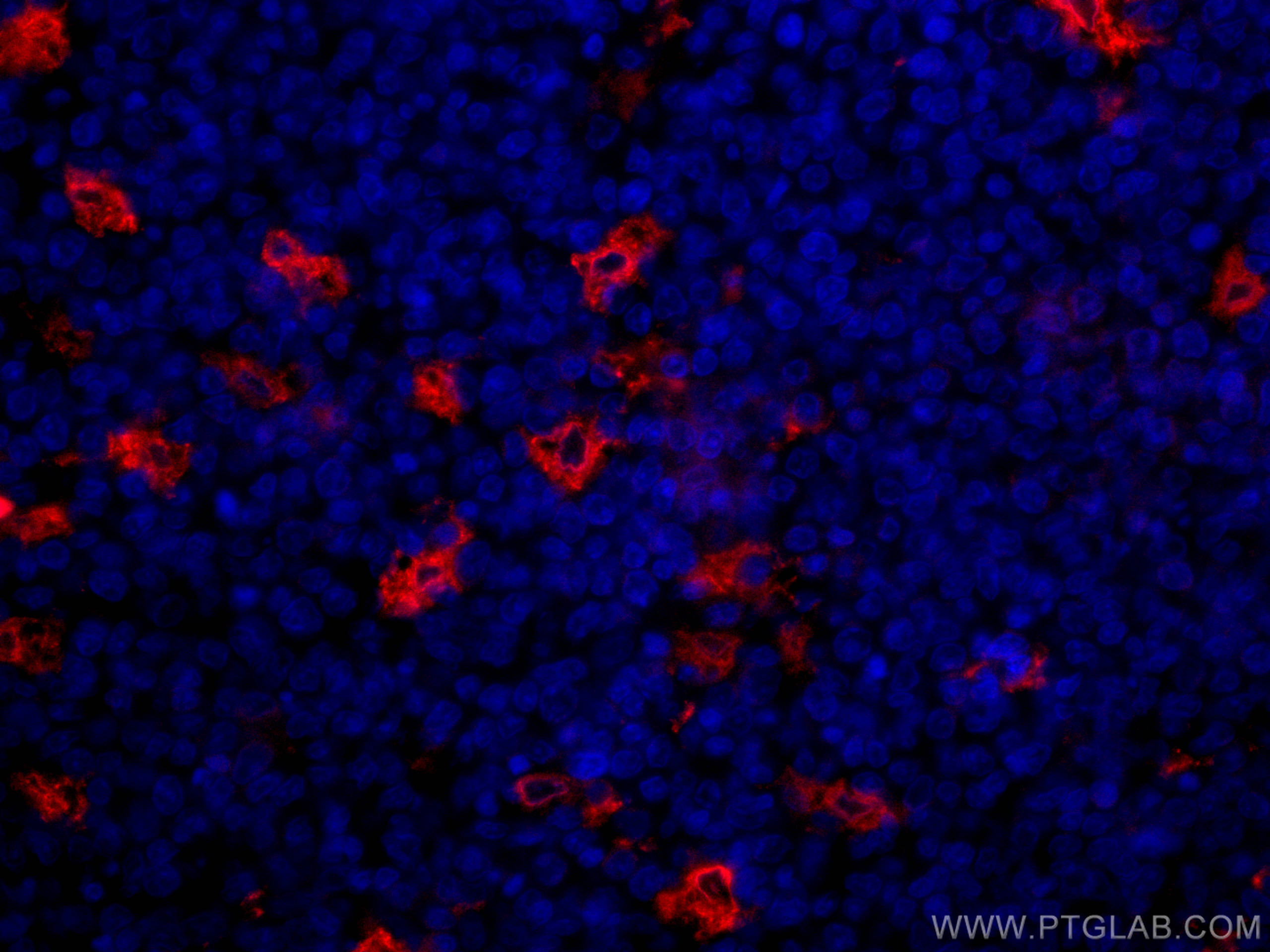 IF Staining of human tonsillitis using CL594-12008