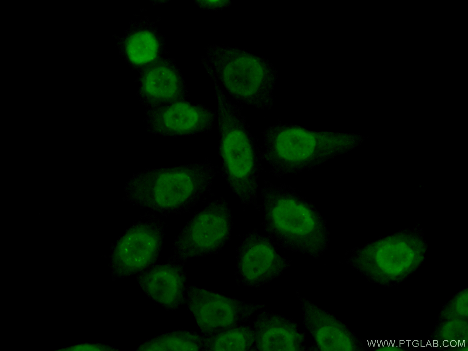 IF Staining of HeLa using 14421-1-AP