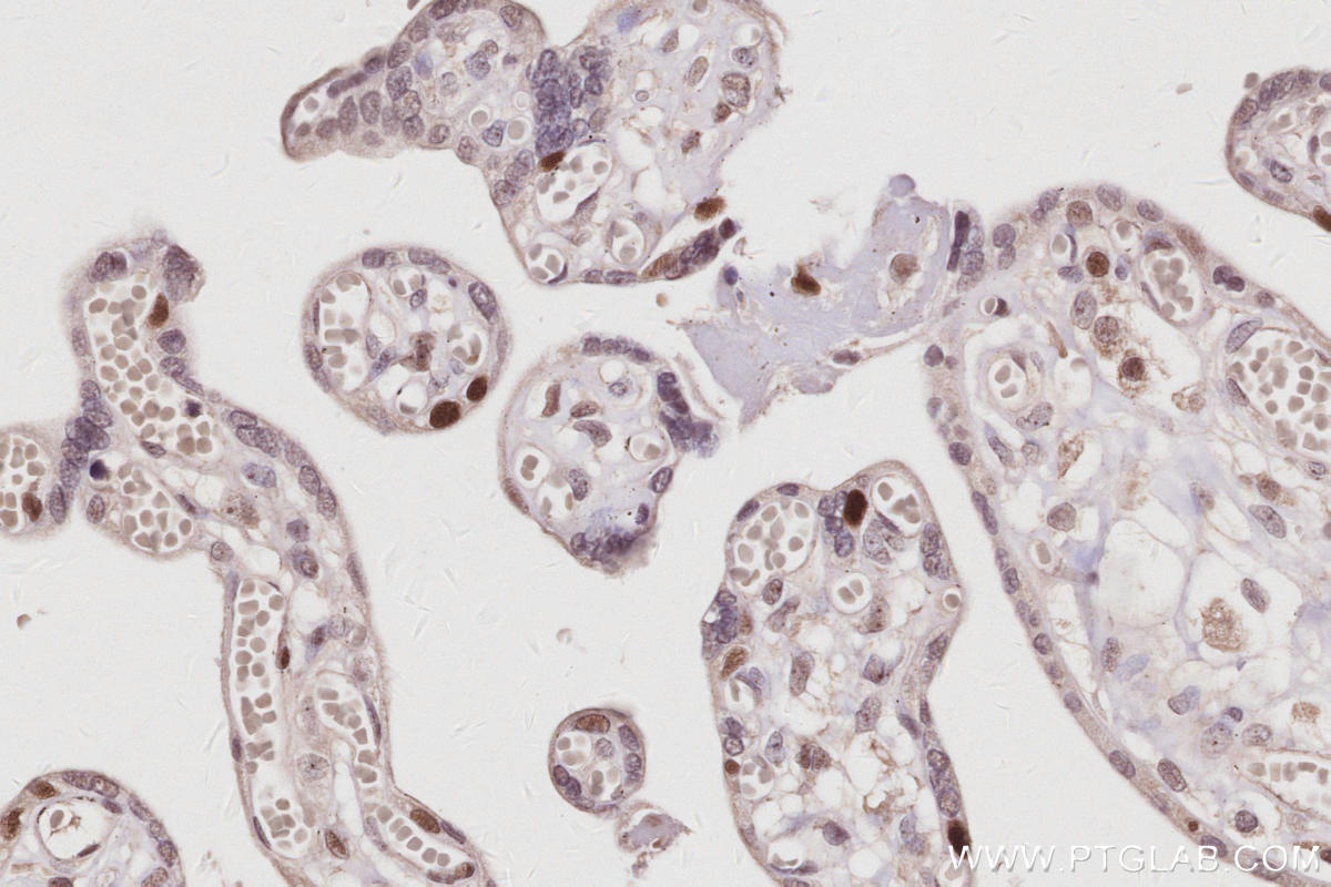 IHC staining of human placenta using 14421-1-AP IHC staining of human placenta using 14421-1-AP