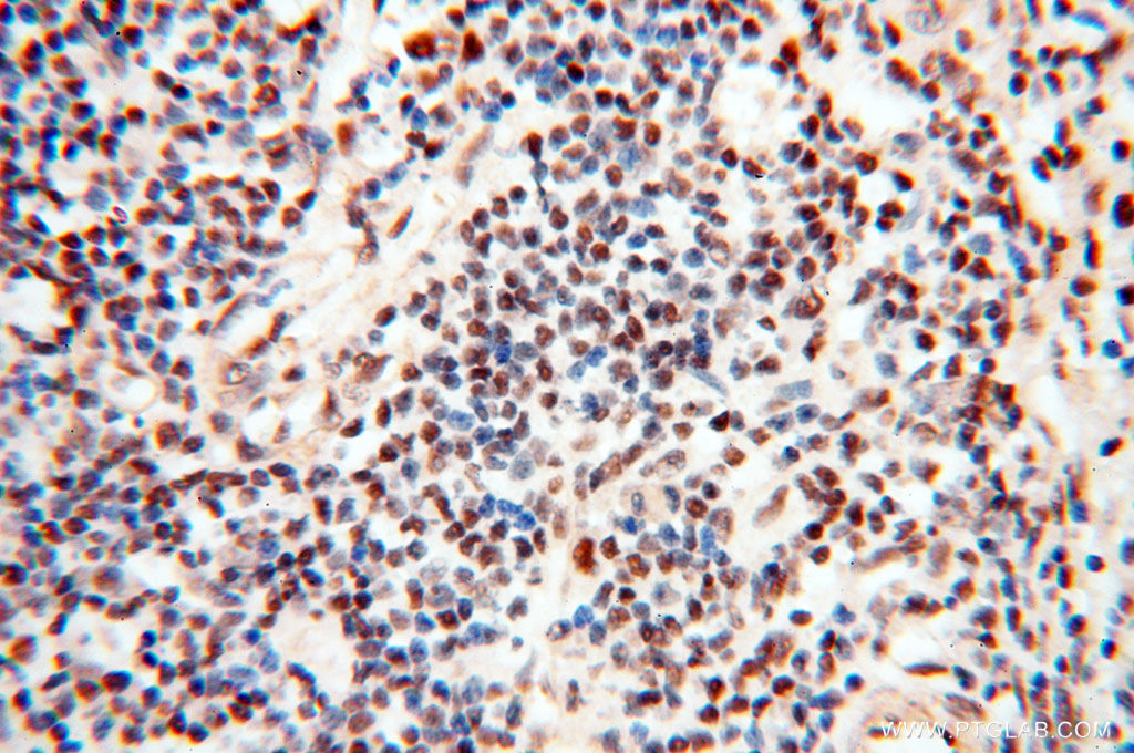 IHC staining of human spleen using 14421-1-AP