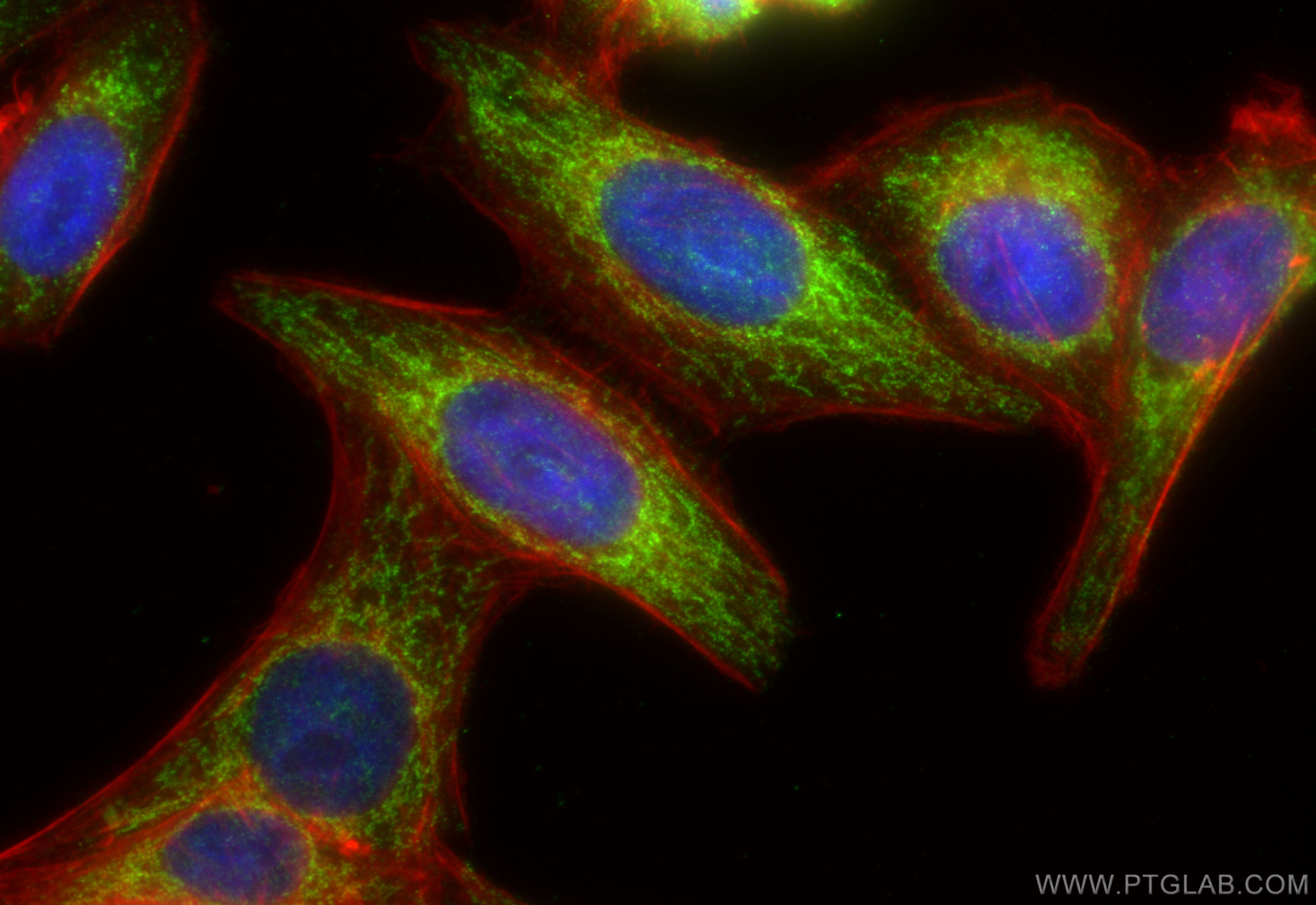 IF Staining of HepG2 using 11124-2-AP