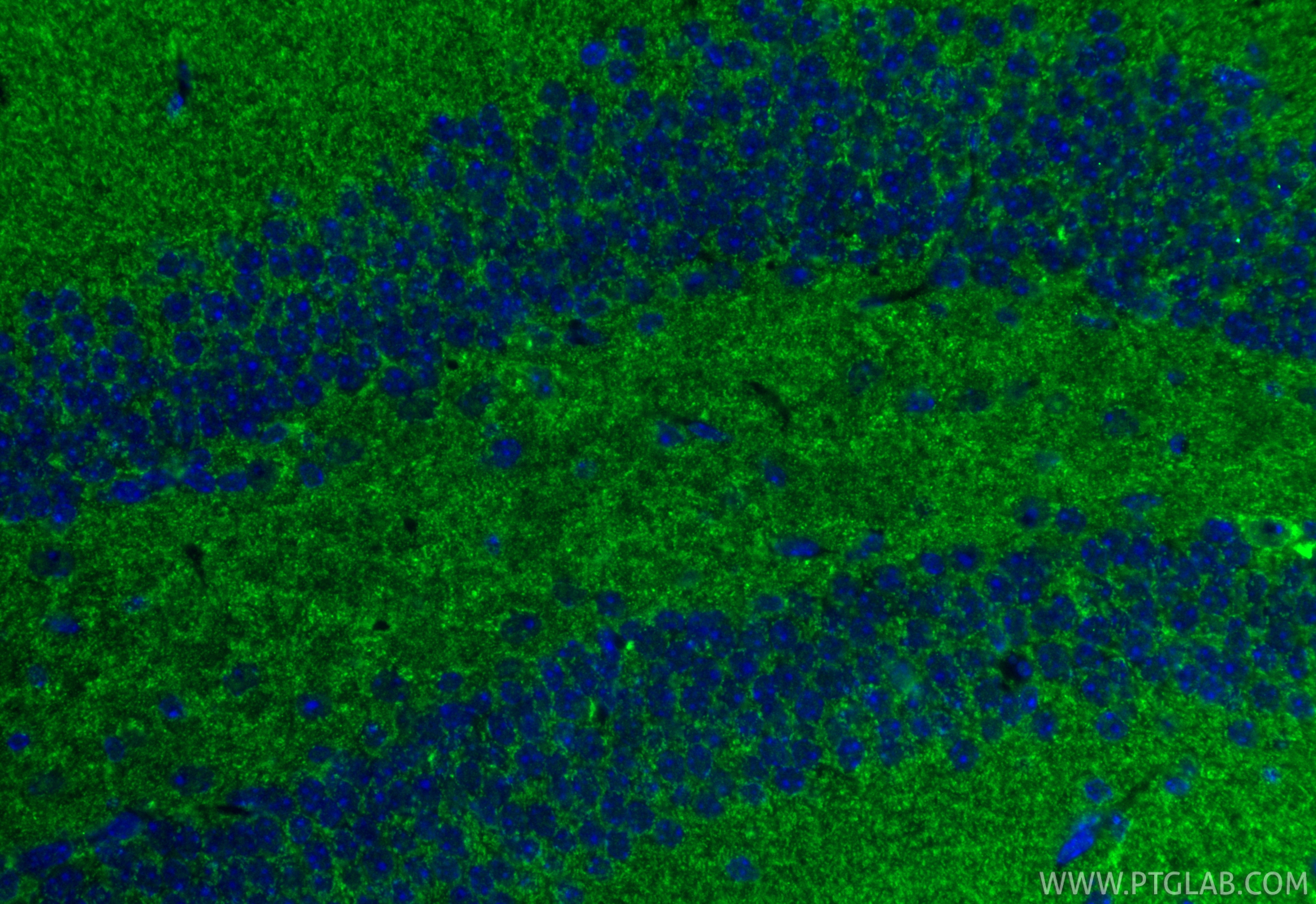IF Staining of mouse brain using 11124-2-AP IF Staining of mouse brain using 11124-2-AP