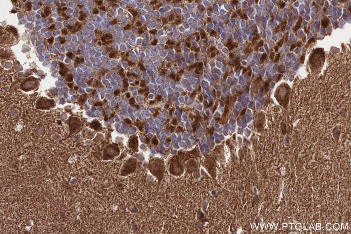 IHC staining of mouse cerebellum using 11124-2-AP