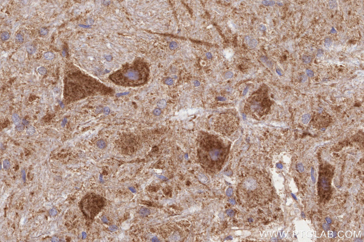IHC staining of rat cerebellum using 11124-2-AP