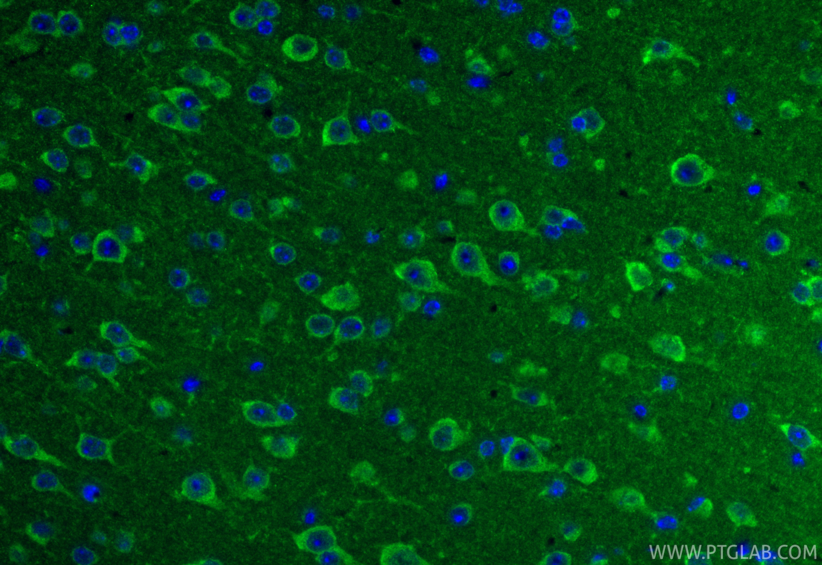 IF Staining of mouse brain using 11189-1-AP (same clone as 11189-1-PBS) IF Staining of mouse brain using 11189-1-AP (same clone as 11189-1-PBS)