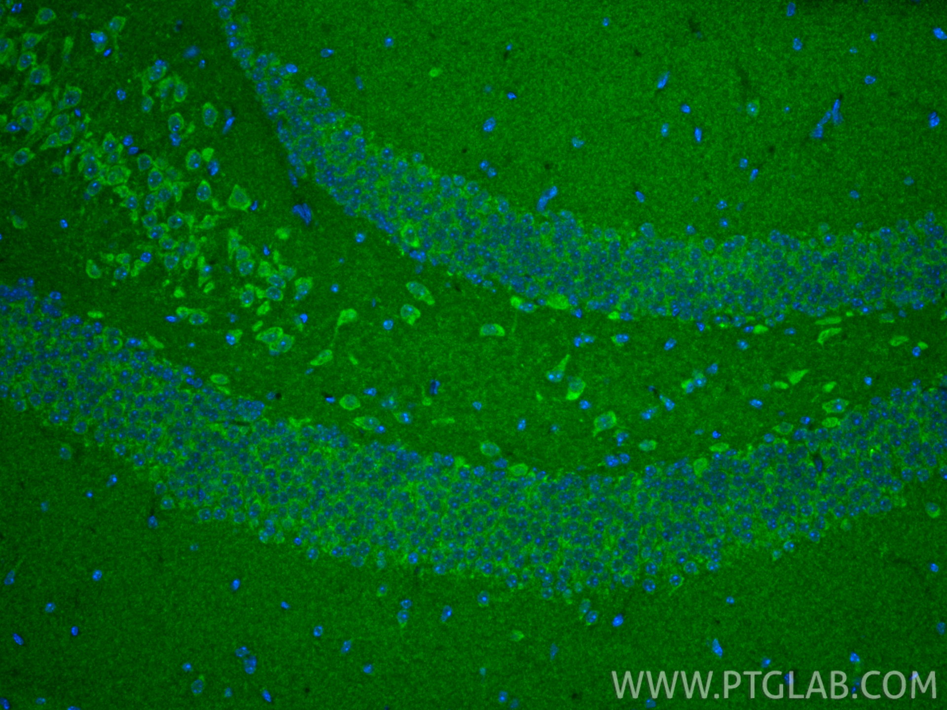 IF Staining of mouse brain using 14927-1-AP (same clone as 14927-1-PBS) IF Staining of mouse brain using 14927-1-AP (same clone as 14927-1-PBS)